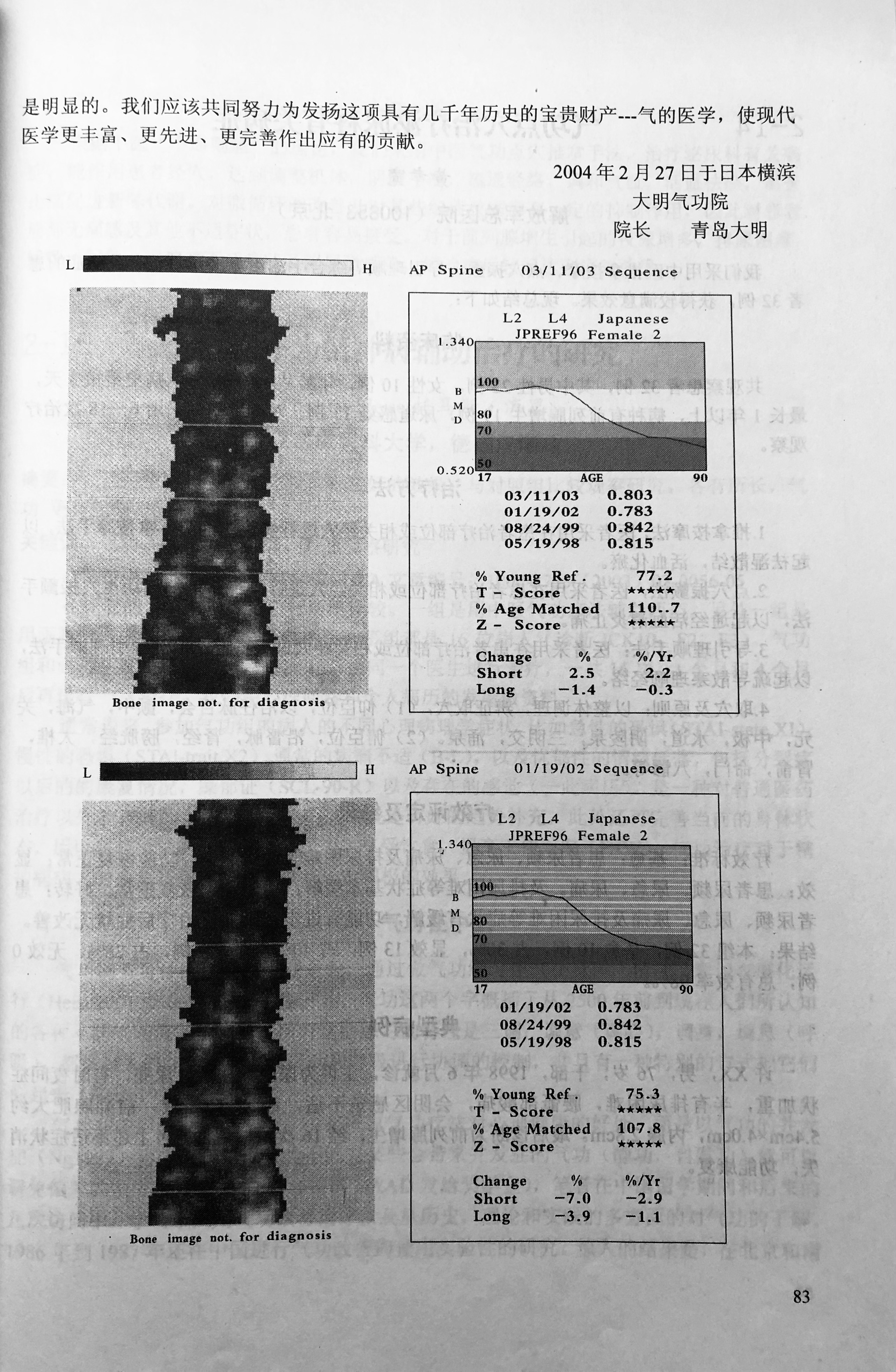 青島大明著　世界医学気功学会発表論文『応用「気の医学」－日本における気功』画像③